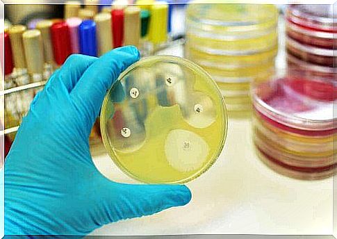 Fungal and Bacteria Analysis