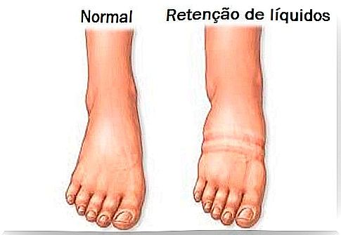 How to fight fluid retention?