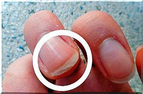 How to harden nails naturally?