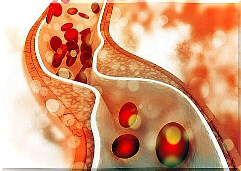 The Risks of Dieting: Cholesterol Problems