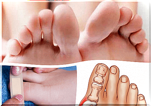 Toe Injuries and Diseases: Know How to Treat Them!