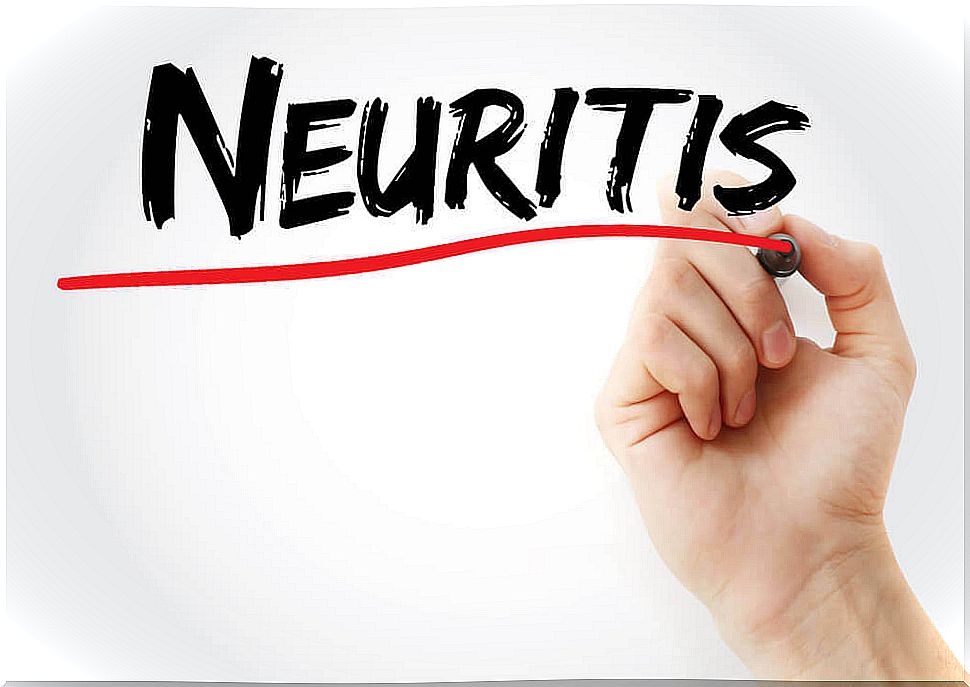 Vestibular neuritis: natural remedies to fight it